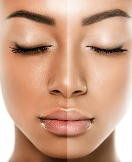 treatment image