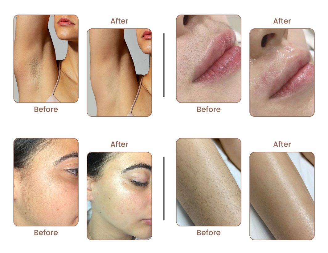 Before After Results